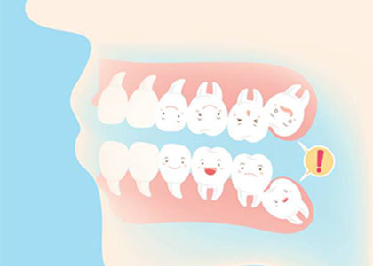 Dr. Matthew Church offers affordable dental care, including the extraction of wisdom teeth.