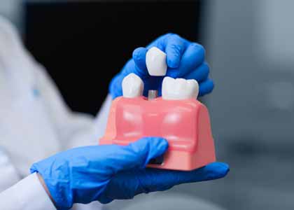 Dental Implants Indianapolis Indiana: To learn more about dental implant treatment, contact Washington Street Dentistry.