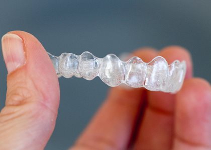 Invisalign aligner therapy from dentist in Indianapolis