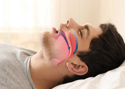 Signs, symptoms, and treatment for obstructive sleep apnea