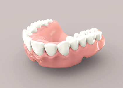 Permanent dentures